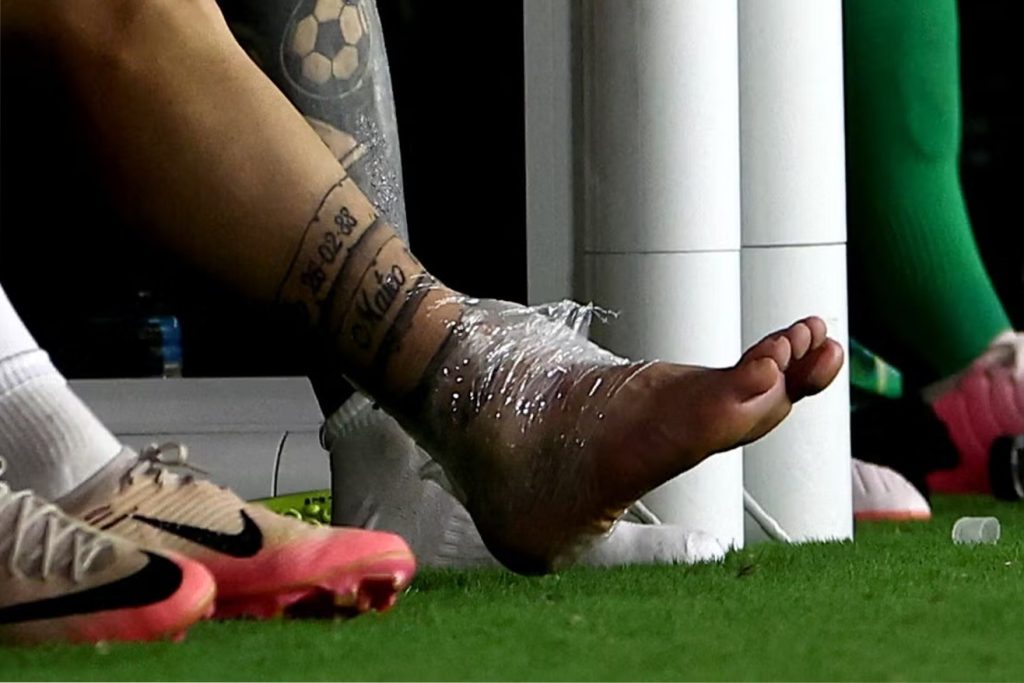 Another closeup of Lionel Messi's ankle injury 