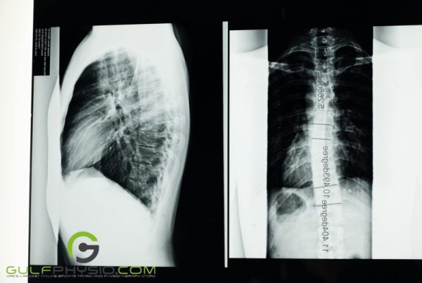 An x-ray of the human abdomen.